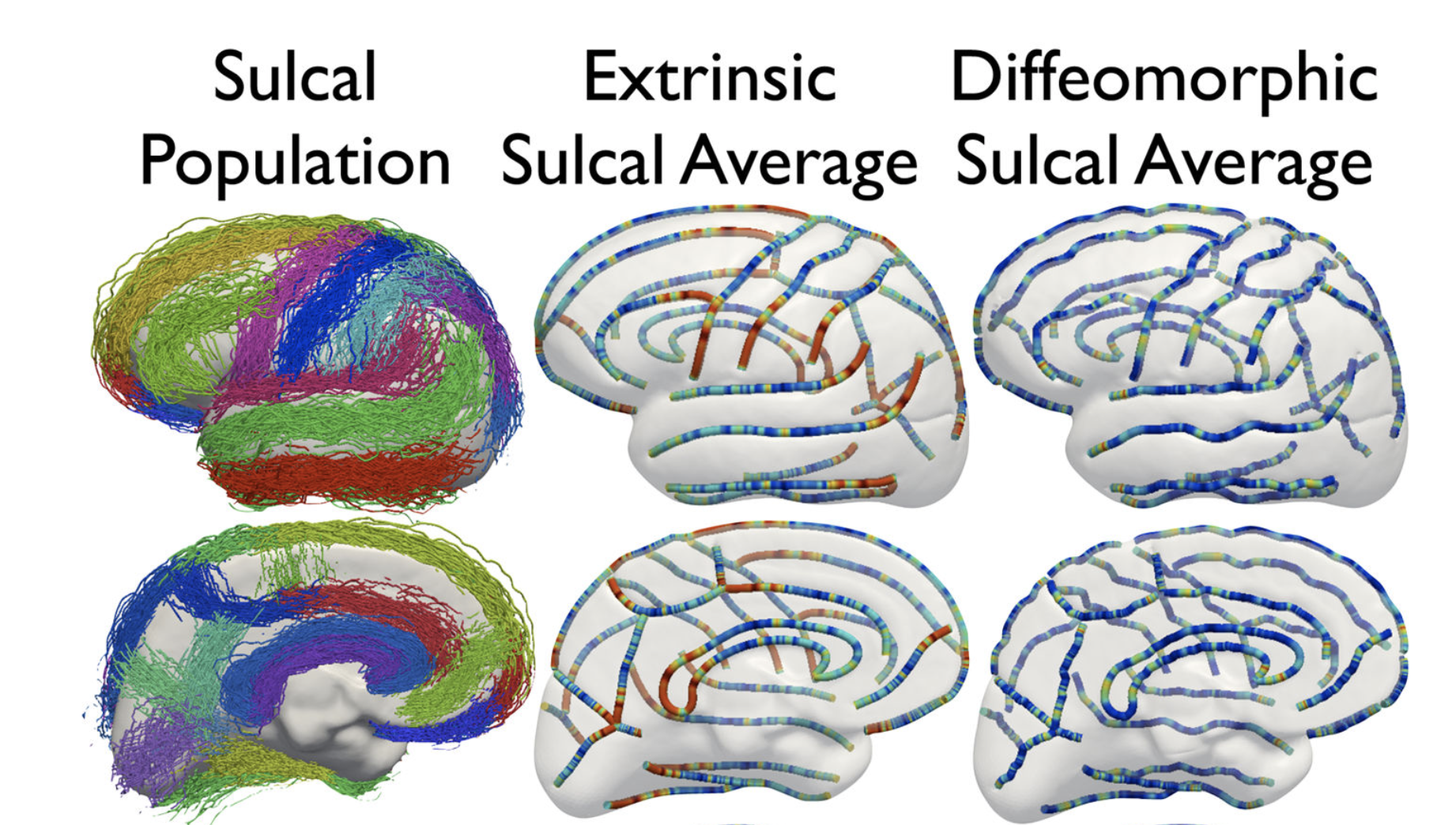 Diffeomorphic Registration