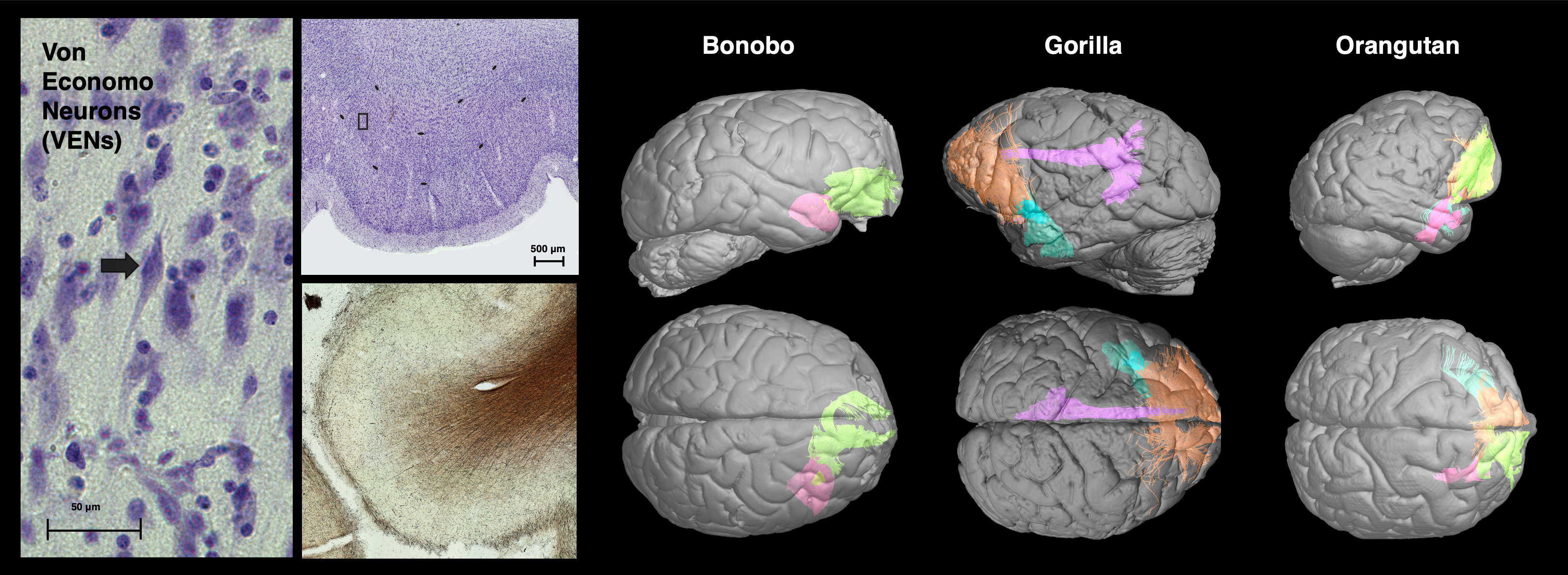 Brain connections research