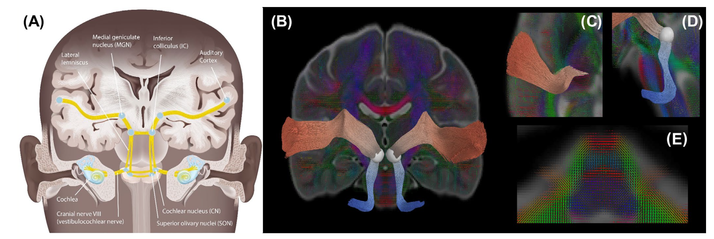Auditory Pathway Maturation