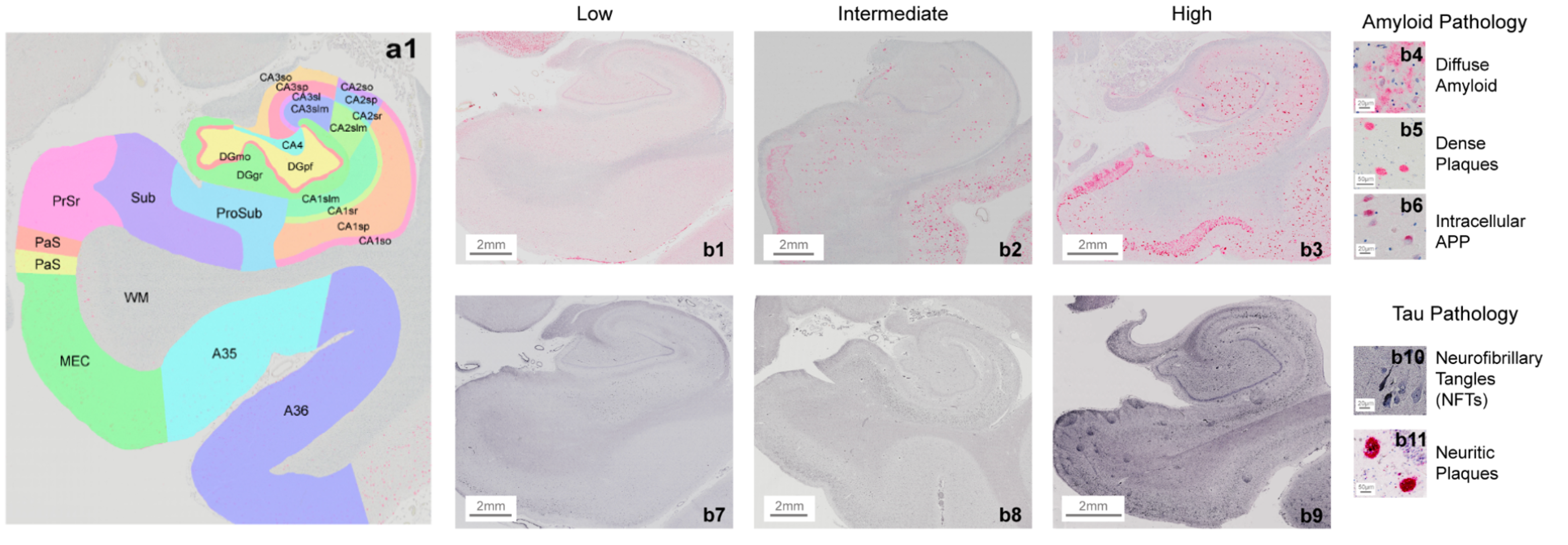 Neuropathology